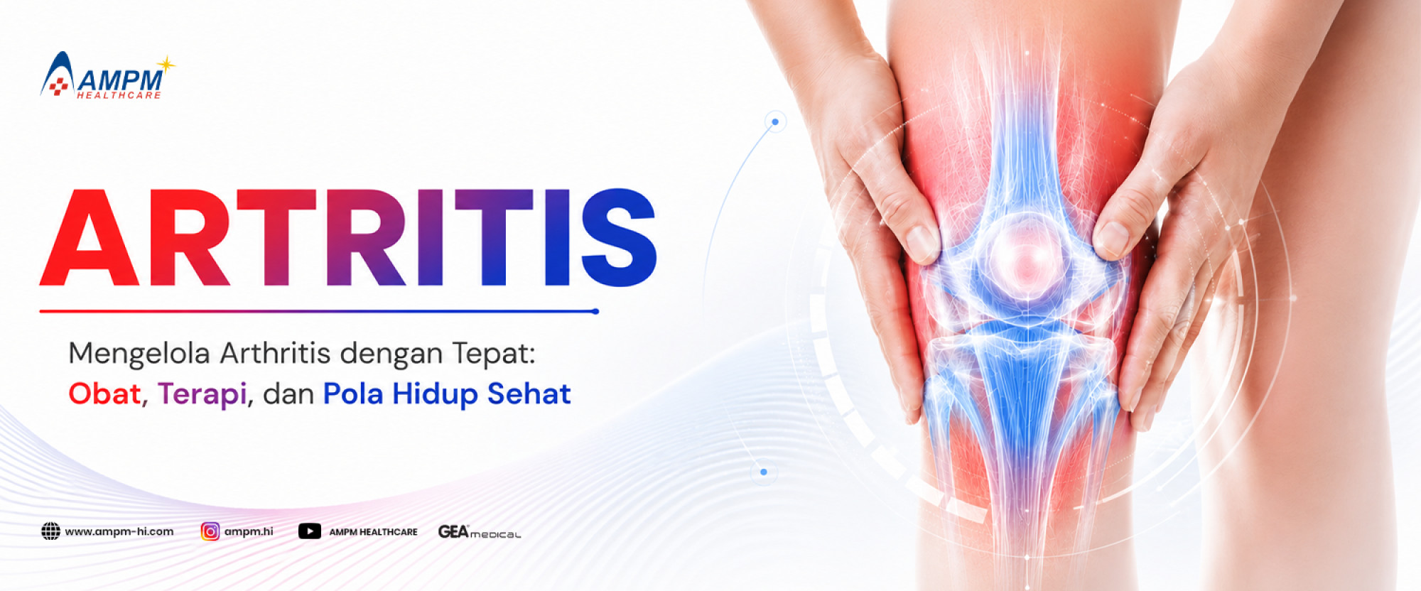 Mengelola Arthritis dengan Tepat